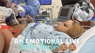 THE LIVE BIRTH OF OUR SECOND SET OF TWINS  Real Raw amp Emotional Doctor Turns Breech Baby in Womb [upl. by Orlan]