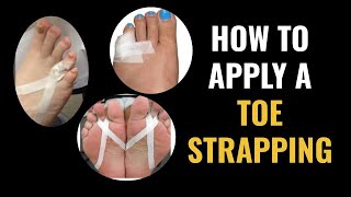 How Do I Do Toe Strapping Dislocated and Fractured Toe [upl. by Swinton]