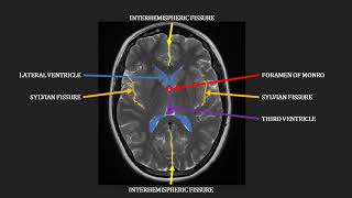 How does an MRI work [upl. by Ahsel]