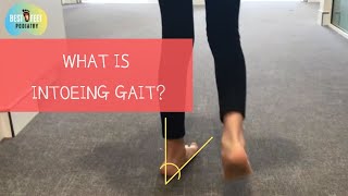 intoeing gait and orthotics therapy [upl. by Adnaw]