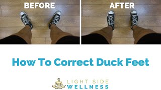 How To Correct Duck Feet Feet Turn Out  Step By Step Program [upl. by Dionysus482]