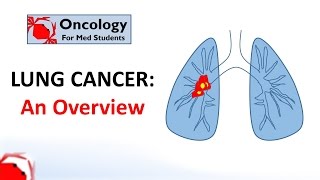 Lung Cancer An Overview [upl. by Aneekas]