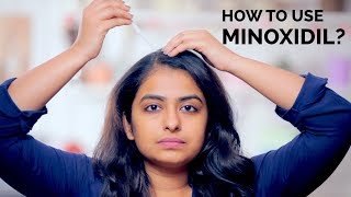 How To Use Minoxidil  Hair Regrowth  Skin Diaries [upl. by Dyolf]