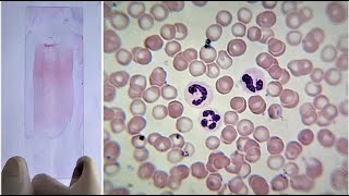 Blood Smear Preparation and Staining Practical Lab [upl. by Codee359]