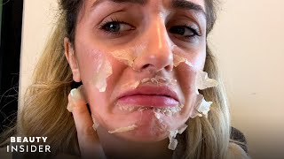 What It’s Like To Get A Chemical Peel For Acne Scars  Beauty Explorers  Beauty Insider [upl. by Larret]