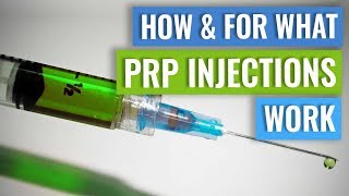 How do PRP injections work [upl. by Nirehtac]