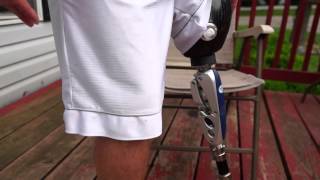 AmputeeOT How An Above Knee AK Prosthetic Leg Works [upl. by Acul]