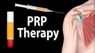 PRP Therapy Animation [upl. by Nolahs]