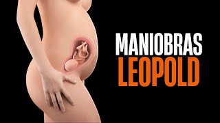 MANIOBRAS DE LEOPOLD [upl. by Maje]