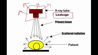 RADIATION PROTECTION  SIMPLIFIED for radiology residents [upl. by Publia179]