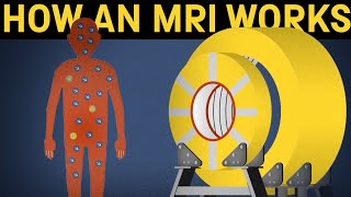 How does an MRI machine work [upl. by Lytton]