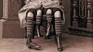 The Story Of Myrtle Corbin The Real Four Legged Girl [upl. by Aileme]