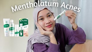 Cara berkesan hilangkan jerawat  Mentholatum Acnes [upl. by Nylissej]