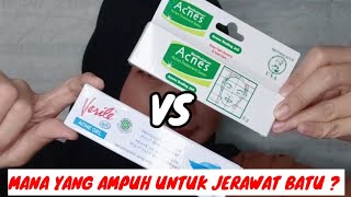 Battle Acnes Sealing Jell VS Verile Acne Gel  Gisti Prilastri [upl. by Constant]