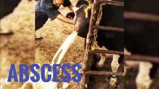 BEST ABSCESS COMPILATION [upl. by Nuawed549]