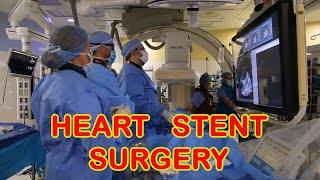 Heart Stent Surgery [upl. by Jud801]