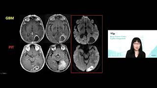 MRI Uses in Diagnosing Conditions [upl. by Laniger]